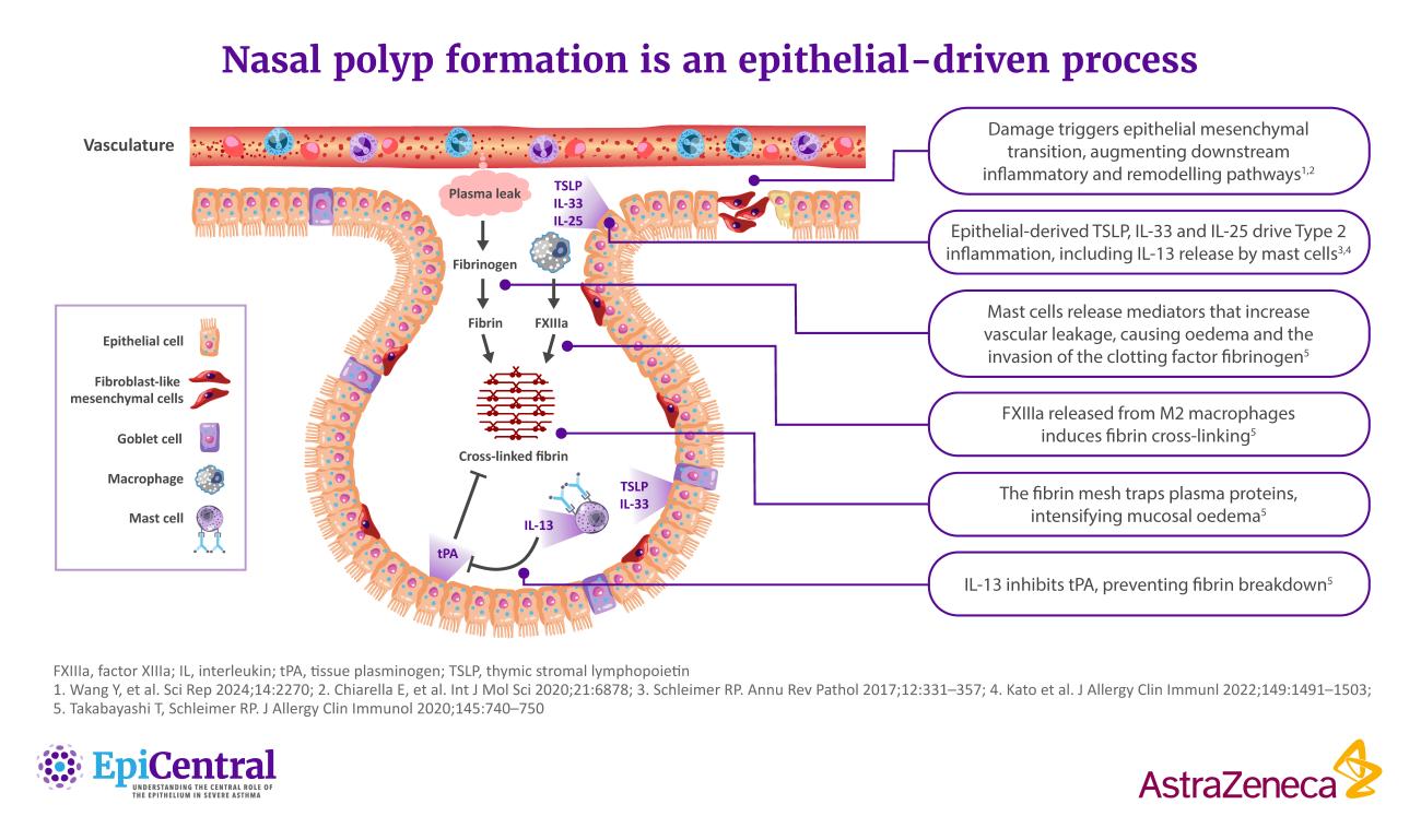 Nasal Polyp Formation